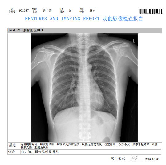 獲得其他 獲得其他